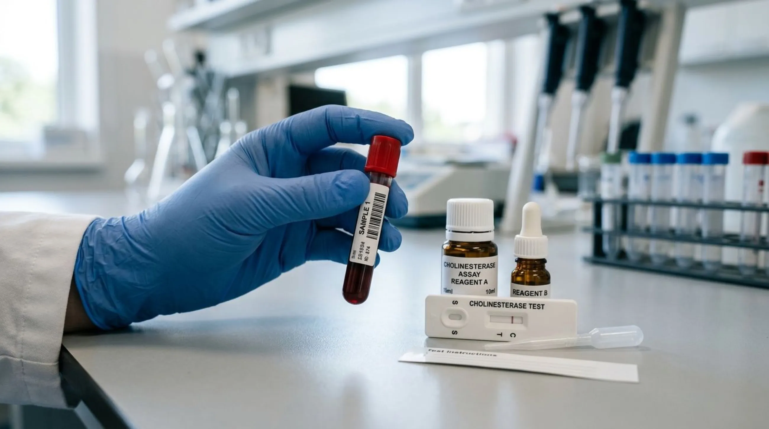 A gloved hand holding a blood sample vial beside a cholinesterase test kit in a laboratory